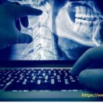 Global Radiology Information System Market Size, Share, Growth ⅼ Forecast (2024-2032) ⅼ Renub Research