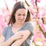 Psoriasis Triggers Stress: How to Manage This Cycle and Find Relief