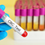 Who Should Get a CBC Test Done? Key Signs and Symptoms